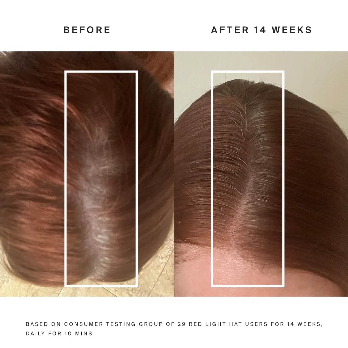 Smilure Hair Regrowth & Therapy Cap